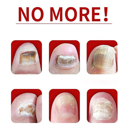 Ginger Nail Treatment Nail Support