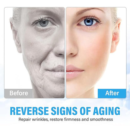 Stem Cell Anti-Aging Serum - Firm, Hydrate, and Renew Your Skin for a Youthful Glow,Strengthens and Moisturises Skin, Micro needling Serum Use with and without Micro Needling