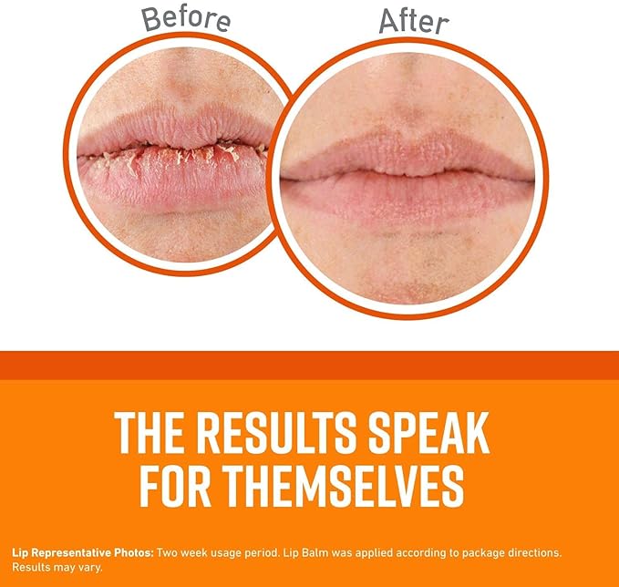 O'Keeffe's Unscented Lip Repair Lip Balm Lips,