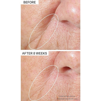 StriVectin Tighten & Lift Peptight Tightening