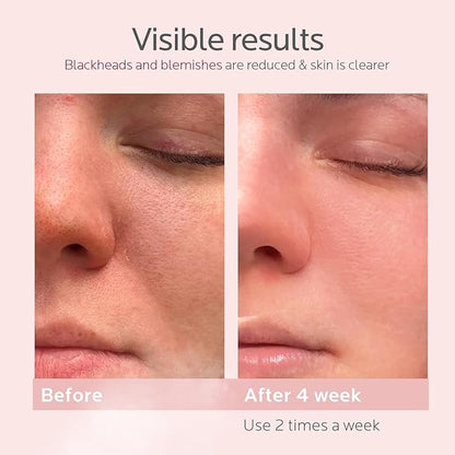 Colorfarm Facial Steamer Skin Care Kit: Face Steamer Home Spa Deep Cleaning Unclogs Pores with 6 Skin Care Tools - Relaxing Self Care Skincare Beauty Gifts for Women Girl (Pore Purifier Pro Kit)