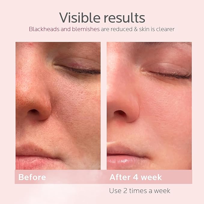 Colorfarm Facial Steamer Skin Care Set: Face Steamer Home Spa Kit Deep Cleaning Unclogs Pores with 6 Skin Care Tools - Spa Relaxing Self Care Gifts for Women (Pro Deep Cleansing Set)