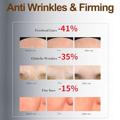 2 Pack Bo-tox Bee Venom Cream for Lifting & Firming Saggy Face/Neck/Eyes, Wrinkle & Fine Lines & Eye Bag Removal, Restoring Elasticity & Deeply Moisturizing, Natural Bee Venom Serum for All Skin Types