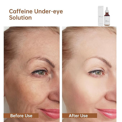 Caffeine Solution 5% + EGCG For Face, 30ML Moisturizing Caffeine Eye Serum For Dark Circles & Puffiness, Under Eye Solution For Fine Lines.