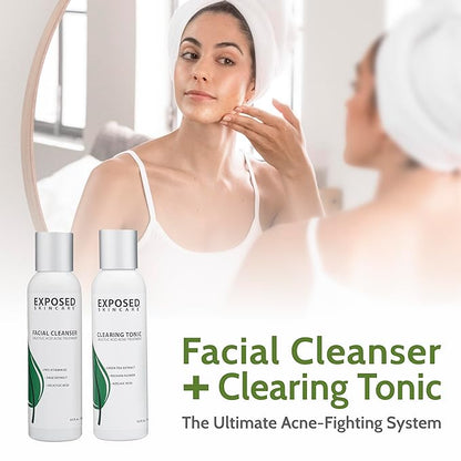 Exposed Skin Care Acne Treatment Kit Clearing