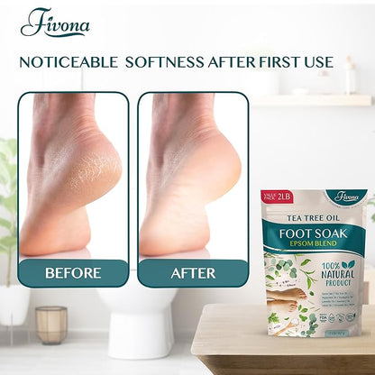 Foot Soak Epsom Salt with Tea Tree Oil 2 LB - Epsom Salt with Essential Oils for Healthy Toenails, Soothing Relief, Callus Softening - Pedicure Therapy for Soft, Rejuvenated Feet