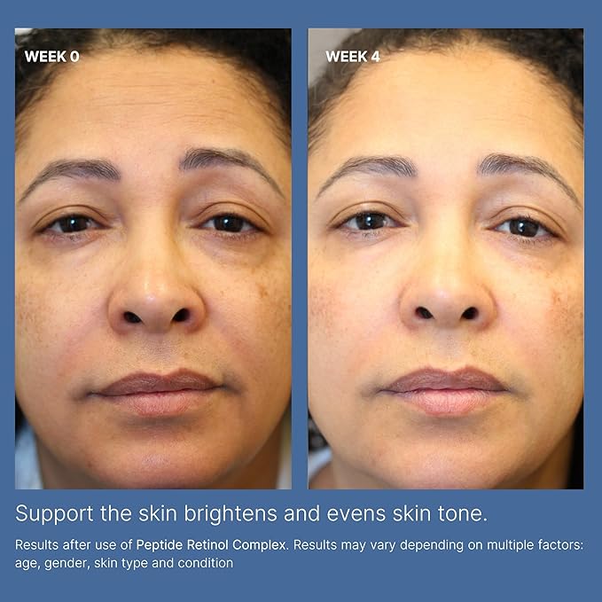 Nu Skin | ageLOC Tru Face Peptide Retinol Complex | 1 Fl Oz | Serum Skincare | Anti Aging Face Serum | Pore Minimizing | Peptide Facial Skin Care Product