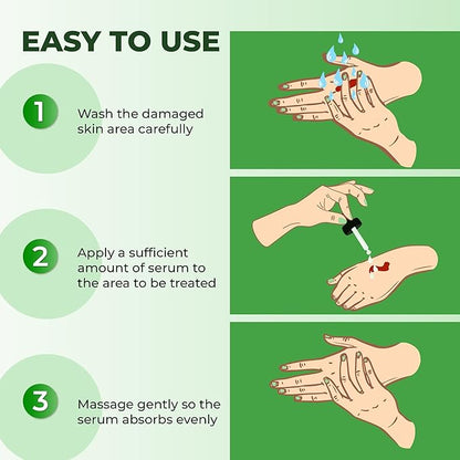 ABERA Alan Silver Serum - Clinically Proven to Soothe Irritated Skin and Improve The Appearance of Skin with Mild to Moderate Psoriasis