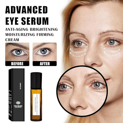 2 PCS Eye Essence Oil Roller Ball Applicator,Castor Frankincense Rollerball, Frankincense and Castor Oil Roller for Eyes, Bags Under Eyes