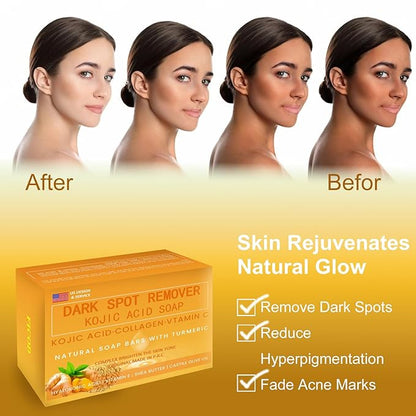 Kojic-Acid-Soap, 2Pack Turmeric Soap for Dark