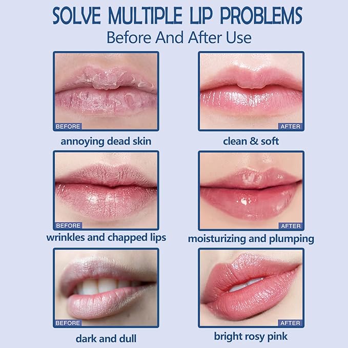 Lip Care Kit Lip Scrubs Exfoliator Lightening