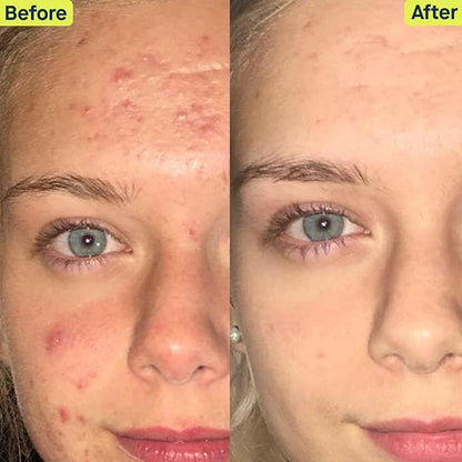 SLMD Skincare by Dr. Pimple Popper