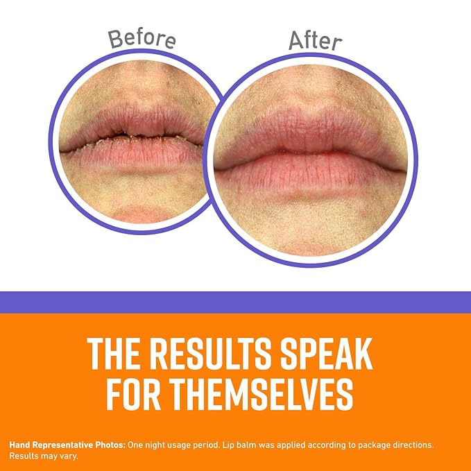 O'Keeffe's Lip Repair Night Treatment Lip