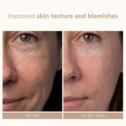 SHANI DARDEN SKIN CARE Lactic Acid Face Serum Travel Size, Active Night Serum to Help with the Look of Radiant and Smooth Skin, Gentle But Powerful Face Exfoliator, 0.34 fl oz