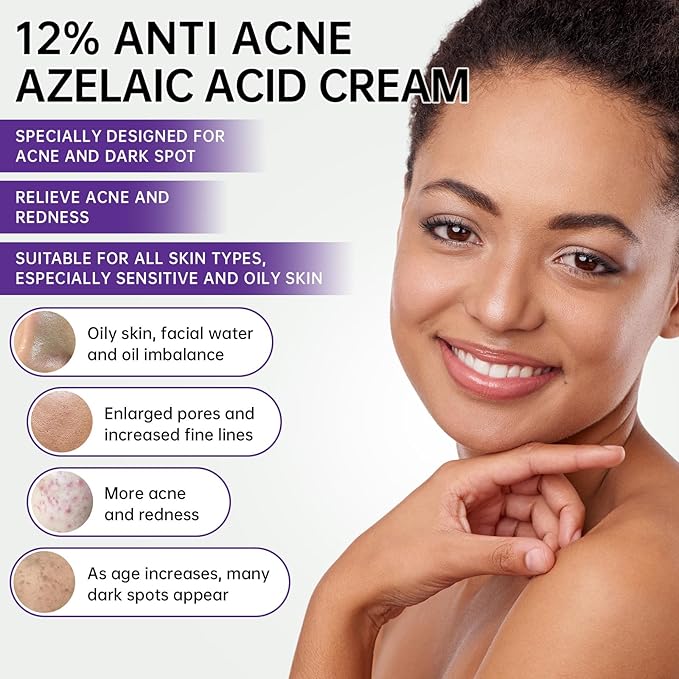 Azelaic Acid 12% Cream For Face, Azelaic Acid Acne Cream For Rosacea Treatment, Redness Relief, 2PCS Azelaic Acid Serum With Salicylic Acid & Niacinamide For Dark Spot, Skin Care.