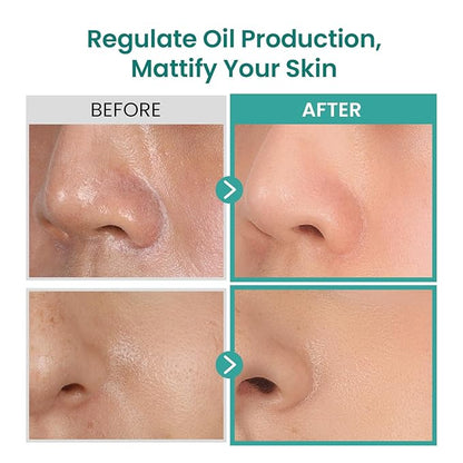 THE SKIN HOUSE 1.69 fl.oz Pore Control Powder Serum, Sebum Control, Soothing | Enlarged Pores, Oily Skin | Green Tea, Panthenol, Tea Tree | Lightweight, Korean Skincare, 50ml