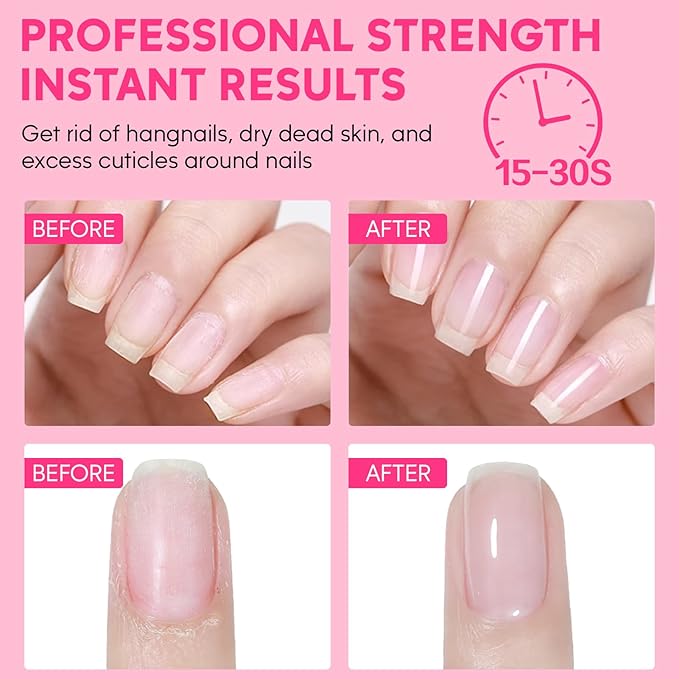 Cuticle Remover Kit - Cuticle