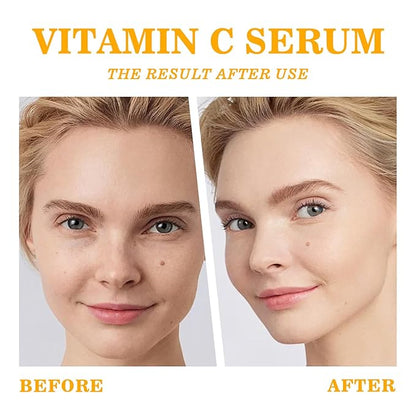 Skin Care Vitamin C Face Serum 1.05oz and Gua sha Facial Tool for Face with Hyaluronic Acid,Hydrolyzed Collagen and Aloe Leaf Extract, Anti-Aging Serum for Wrinkles & Dark Spot