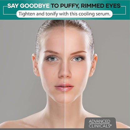 Advanced clinicals puffy eyes treatment