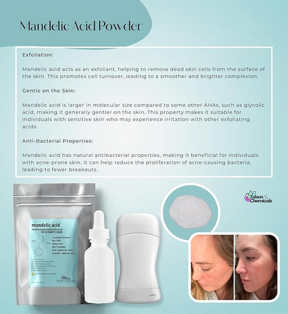 Mandelic Acid Powder 99.9% Purity, DIY Cosmetic Grade For Mandelic Acid Serum, Peel/Mask or add to Cream, Moisturizer (4 Ounce / 113 Gram)