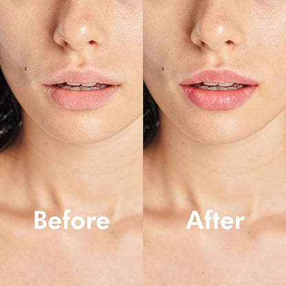 PURSONIC Lip Mask Overnight for Ultimate Blossom