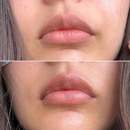 Talika Smile Patch | New Hydrating Lips