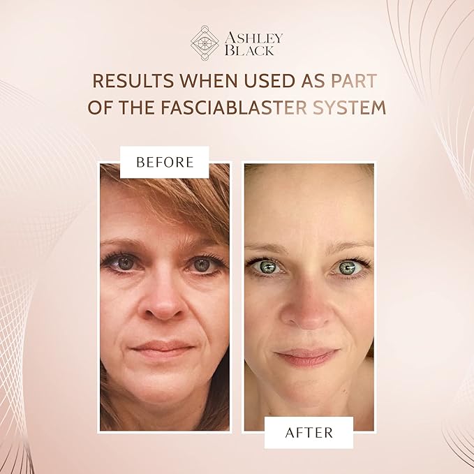 The Single Claw FasciaBlaster by Ashley Black. Collagen Boosting Tool. Sculpt Jawline. Smooth Wrinkles. Restore Fascia Tissue that Supports Tight Skin. Our Smallest FasciaBlaster