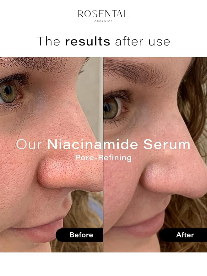 Organics Hydrating Facial Serum - 100% Vegan & Natural Cosmetics (30 ml, Niacinamide Serum)
