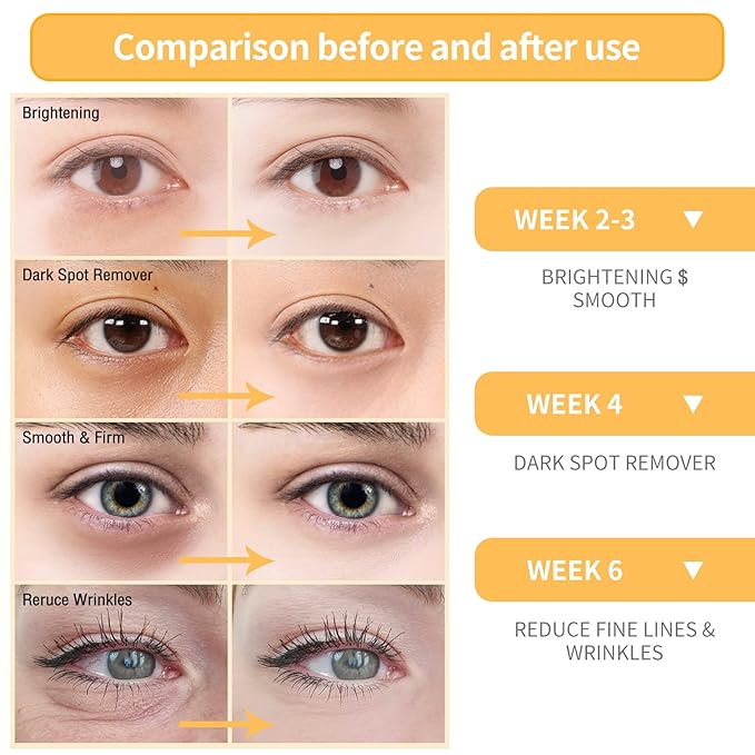 BREYLEE Vitamin C Serum for Face & Eye (o.6 oz) for Brightening Skin,Dark Spot Remover,Reduce Wrinkle,Anti Aging Serum,Moisturizer Brightening Serum with Hyaluronic Acid,Vitamin E,Retinol, Niacinamide