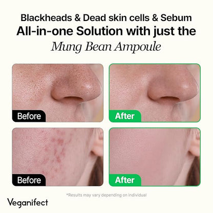 Mung Bean Serum, Enhancing Moisture Barrier, Gentle Exfoliation, For Glow Skin, Korean Skin Care, Vegan, 1.69 Fl Oz