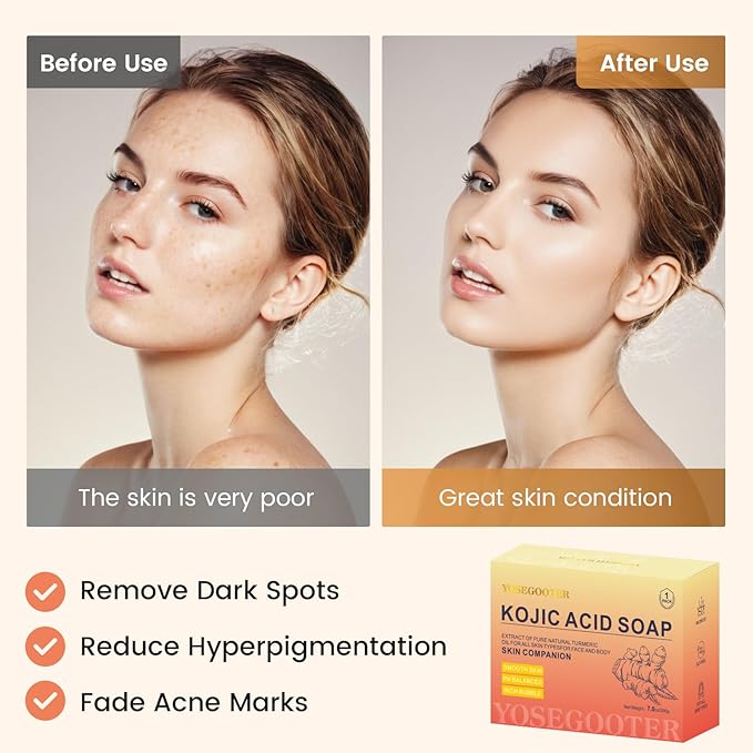 Turmeric Kojic Acid Soap Bars -