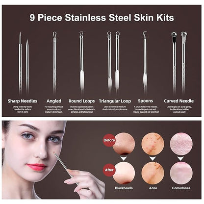 Newbealer Facial Steamer, Mini Aroma Face Steamer, Nano Ionic Hot Mist Face Humidifier for Facial Deep Cleaning, Home Sauna Spa Sprayer with 9 Pieces Acne Remover Kit (Blue, 160 ml)