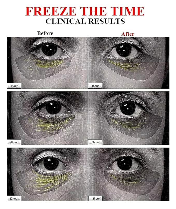 ULTIMATE [Human Stem Cell + (10%) PDRN] Healing Booster Overnight Serum―for Minimizes Wrinkles, Discoloration (10ml x 5vials)