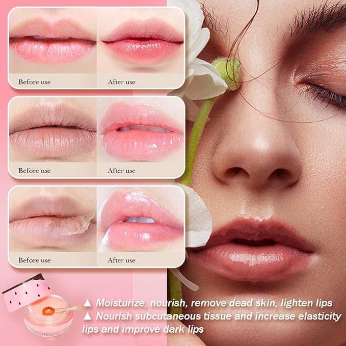4 Pcs Honey Lip Balm, Strawberry Lime+Watermelon)