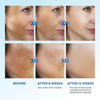 Abera Dark Spot Serum for Face, Dark Spot Corrector, Melasma & Age Spot Treatment, Boost Moisturization & Pore Minimize, All Skin Types, 0.68 fl Oz