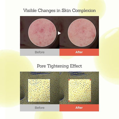 MEDITHERAPY Retinal Skin Booster Serum 5.07 fl. oz - 100ppm Retinal Ideal for Beginner & Sensitive Skin - Advanced Retinol Serum for Face - Retinaldehyde Facial Serum for Uneven Skin Tone & Fine Lines