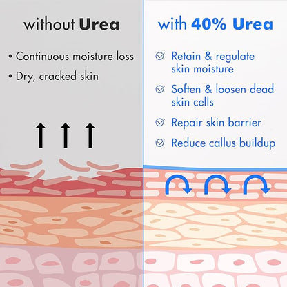 Ebanel Urea Cream 40% plus Salicylic Acid 2%, Foot Cream for Dry Cracked Heels Feet Knees Elbows Hands, Foot Dead Skin Cuticle Callus Remover Toenail Softener, Keratolytic Skin Barrier Repair, 2-Pack