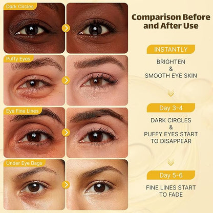 Under eye patches 20 pairs,