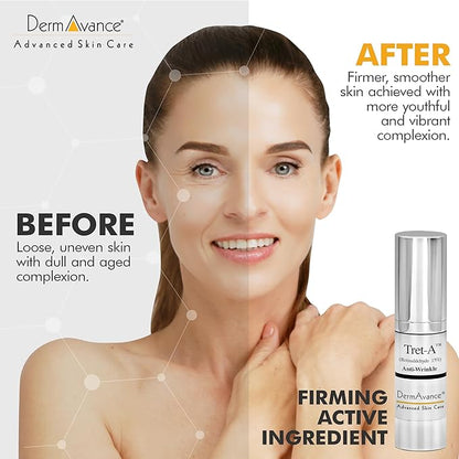 Tret-A Anti Aging Face Cream - Retinaldehyde 0.15% Lotion for Advanced Anti-Aging and Radiance - Face Lotion for Women - Facial Anti-Wrinkle Care 15ml