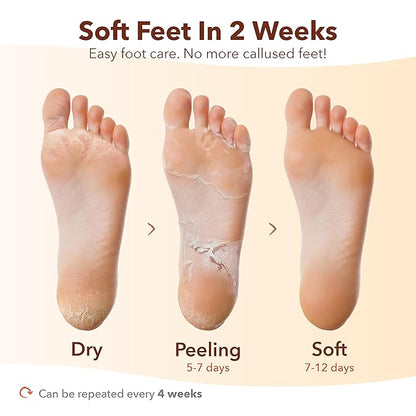 Purederm Exfoliating Foot Mask (3 Pack) – Regular Size Exfoliating Foot Masks for Cracked Feet, Dry Skin, Callused Feet…