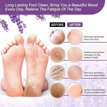 foot salt set Foot Soak with Epsom Salt - For Toenail Repair, Athletes Foot, Softens Calluses, Soothes Sore & Tired Feet…