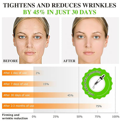 2Pack Vitamin C Serum for Face - Anti Aging Facial Serum with Vitamin C, Hyaluronic Acid, Vitamin E, Promotes Collagen Synthesis, Reduces Dark Spots And Wrinkles, 4.04 Fl Oz