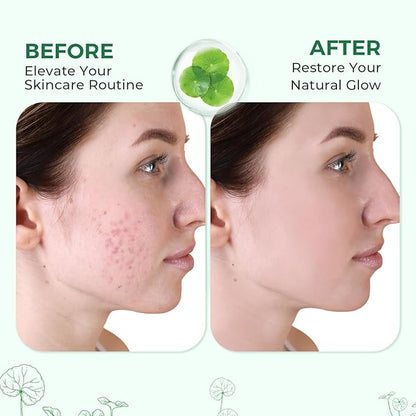 Centella Serum, Face Hydrating Fermented Centella Asiatica Serum, Soothing, Barrier Repair, Firming, Revitalize Glowing Centella Ampoule Facial Moisturizer with Ceramide NP, for All Skin (50ml)