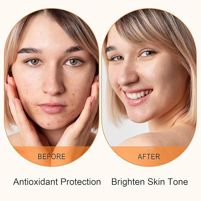 Vitamin C Serum for Face with Hyaluronic Acid – 1.5ml x 30PCS, Brightening Hydrating Facial Serum, Travel Size Skincare for Glowing Skin(1.52 Fl Oz (Pack of 1))