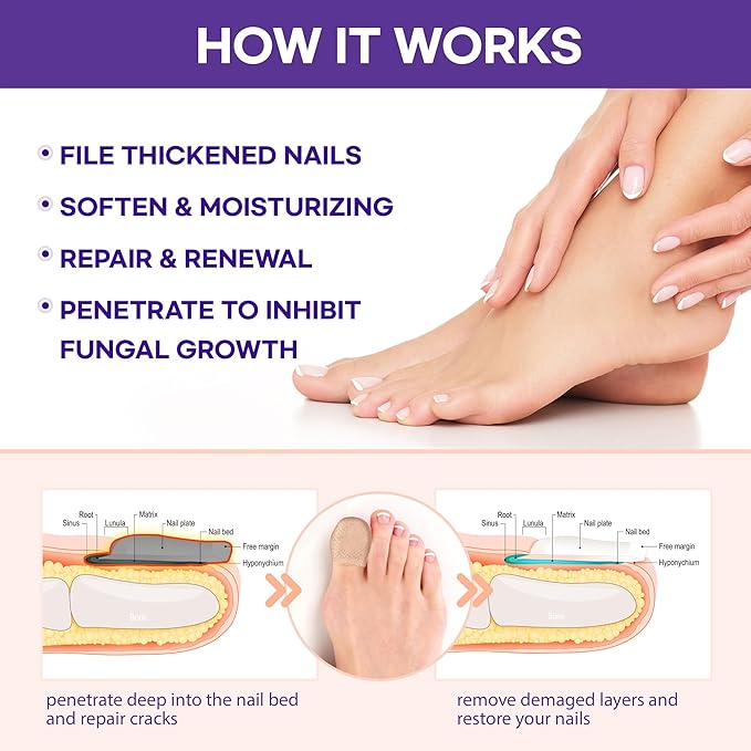 Extra Strength Toenail Fungus Treatment
