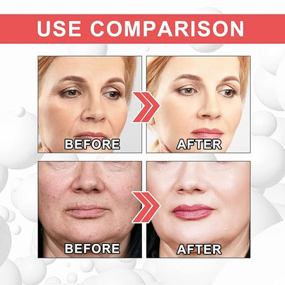 3Pcs EELHOE Collagen Boost Anti Aging Serum, EELHOE Collagen Anti-Wrinkle Cream, Voletas Collagen Boost Anti-Aging Serum
