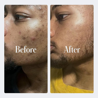 Geologie Clear System | 3-Step Acne