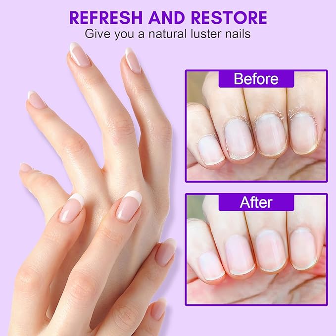 Makartt Cuticle Remover Kit, Nail