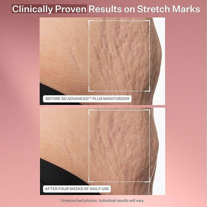 Strivectin anti wrinkle trio kit
