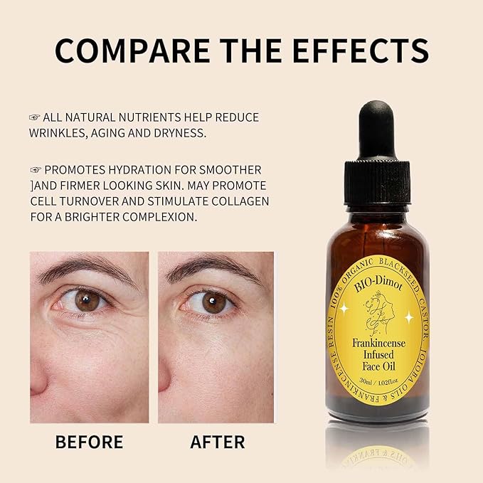 2 Pcs Frankincense Resin Oil, Organic Frankincense Infused Black Seed and Castor and Jojoba Oils for Skin Hydration Anti-Aging Face Serum.